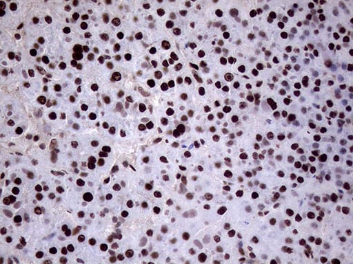 Immunohistochemistry XRN2 Antibody (OTI5F4)