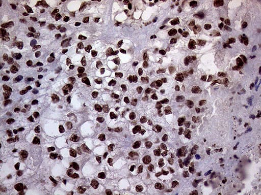 Immunohistochemistry XRN2 Antibody (OTI5F4)