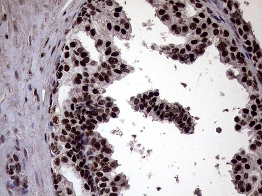 Immunohistochemistry XRN2 Antibody (OTI5F4)
