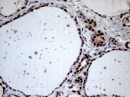 Immunohistochemistry XRN2 Antibody (OTI5F4)