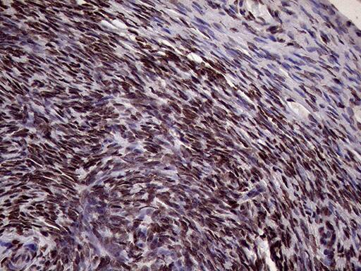 Immunohistochemistry XRN2 Antibody (OTI5F4)