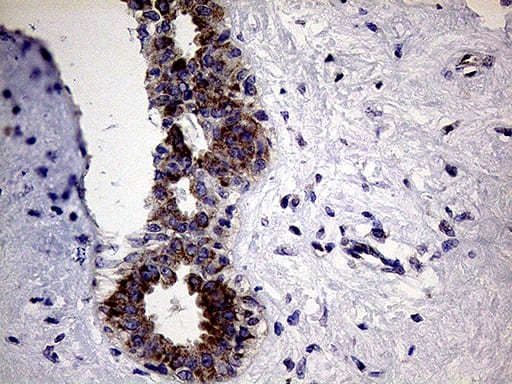 Immunohistochemical staining of paraffin-embedded Human breast tissue within the normal limits using anti-CLIP4 mouse monoclonal antibody. Heat-induced epitope retrieval by EDTA solution buffer pH 8.0 at 120Â°C for 3 min.