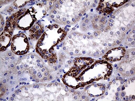 Immunohistochemical staining of paraffin-embedded Human Kidney tissue within the normal limits using anti-CLIP4 mouse monoclonal antibody. Heat-induced epitope retrieval by EDTA solution buffer pH 8.0 at 120Â°C for 3 min.