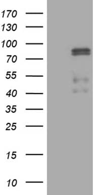 HEK293T cells were transfected with the pCMV6-ENTRY control ( Left lane) or pCMV6-ENTRY CLIP4 ( Right lane) cDNA for 48 hrs and lysed. Equivalent amounts of cell lysates (5 ug per lane) were separated by SDS-PAGE and immunoblotted with anti-CLIP4 (1:2000). Positive lysates
