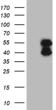 HEK293T cells were transfected with the pCMV6-ENTRY control (Left lane) or pCMV6-ENTRY BCL7B (, Right lane) cDNA for 48 hrs and lysed. Equivalent amounts of cell lysates (5 ug per lane) were separated by SDS-PAGE and immunoblotted with anti-BCL7B (1:2000). 
