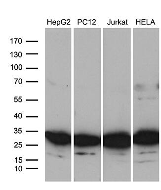 Western blot analysis of extracts (35ug) from 4 different cell lines by using anti-RPL10A monoclonal antibody (1:500).