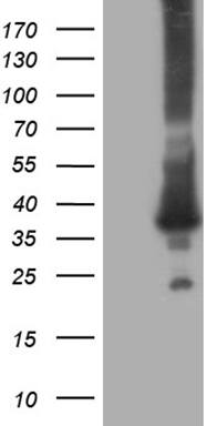 HEK293T cells were transfected with the pCMV6-ENTRY control (Left lane) or pCMV6-ENTRY RAB23 (, Right lane) cDNA for 48 hrs and lysed. Equivalent amounts of cell lysates (5 ug per lane) were separated by SDS-PAGE and immunoblotted with anti-RAB23 (1:2000). 