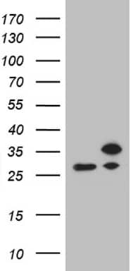HEK293T cells were transfected with the pCMV6-ENTRY control ( Left lane) or pCMV6-ENTRY RPL10A ( Right lane) cDNA for 48 hrs and lysed. Equivalent amounts of cell lysates (5 ug per lane) were separated by SDS-PAGE and immunoblotted with anti-RPL10A (1:500). Positive lysates