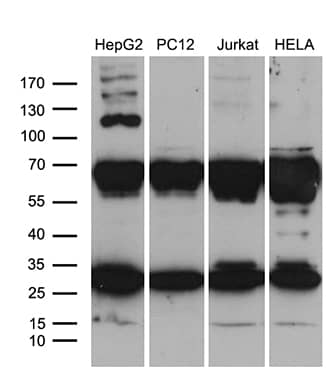 Western blot analysis of extracts (35ug) from 4 different cell lines by using anti-RPL10A monoclonal antibody (1:500).
