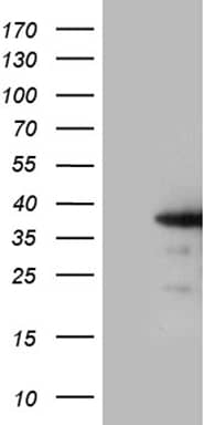 HEK293T cells were transfected with the pCMV6-ENTRY control (Left lane) or pCMV6-ENTRY ZCCHC17 (, Right lane) cDNA for 48 hrs and lysed. Equivalent amounts of cell lysates (5 ug per lane) were separated by SDS-PAGE and immunoblotted with anti-ZCCHC17 (1:2000). 