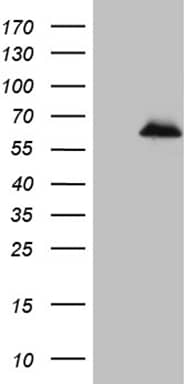 HEK293T cells were transfected with the pCMV6-ENTRY control (Left lane) or pCMV6-ENTRY ZNF329 (, Right lane) cDNA for 48 hrs and lysed. Equivalent amounts of cell lysates (5 ug per lane) were separated by SDS-PAGE and immunoblotted with anti-ZNF329 (1:2000). 