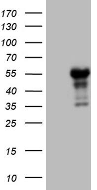 HEK293T cells were transfected with the pCMV6-ENTRY control (Left lane) or pCMV6-ENTRY LHX4 (, Right lane) cDNA for 48 hrs and lysed. Equivalent amounts of cell lysates (5 ug per lane) were separated by SDS-PAGE and immunoblotted with anti-LHX4 (1:2000). 