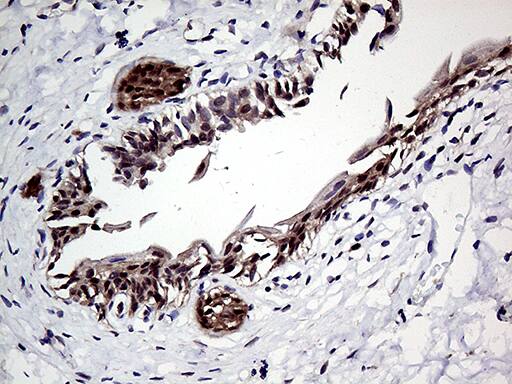 Immunohistochemical staining of paraffin-embedded Human bladder tissue within the normal limits using anti-ZNF329 mouse monoclonal antibody. Heat-induced epitope retrieval by EDTA solution buffer pH 8.0 at 120Â°C for 3 min.