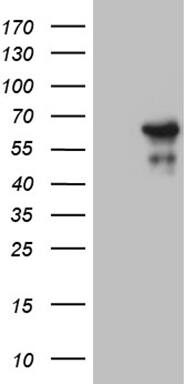 HEK293T cells were transfected with the pCMV6-ENTRY control ( Left lane) or pCMV6-ENTRY ZNF329 ( Right lane) cDNA for 48 hrs and lysed. Equivalent amounts of cell lysates (5 ug per lane) were separated by SDS-PAGE and immunoblotted with anti-ZNF329(1:2000). Positive lysates