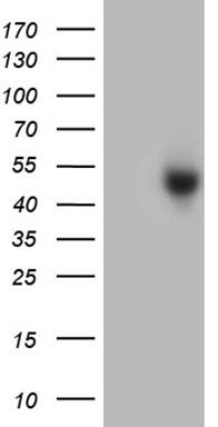 HEK293T cells were transfected with the pCMV6-ENTRY control ( Left lane) or pCMV6-ENTRY ZCWPW2 ( Right lane) cDNA for 48 hrs and lysed. Equivalent amounts of cell lysates (5 ug per lane) were separated by SDS-PAGE and immunoblotted with anti-ZCWPW2(1:2000). Positive lysates