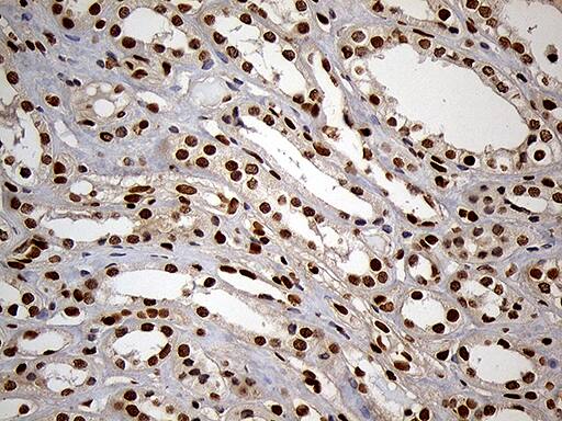 Immunohistochemical staining of paraffin-embedded Human Kidney tissue within the normal limits using anti-MEIS1 mouse monoclonal antibody. Heat-induced epitope retrieval by EDTA solution buffer pH 8.0 at 120Â°C for 3 min.