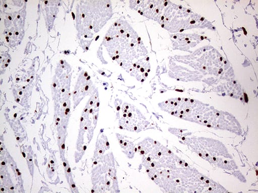 Immunohistochemical staining of paraffin-embedded Human bladder tissue within the normal limits using anti-MEIS1 mouse monoclonal antibody. Heat-induced epitope retrieval by EDTA solution buffer pH 8.0 at 120Â°C for 3 min.