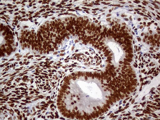 Immunohistochemical staining of paraffin-embedded Human endometrium tissue within the normal limits using anti-MEIS1 mouse monoclonal antibody. Heat-induced epitope retrieval by EDTA solution buffer pH 8.0 at 120Â°C for 3 min.