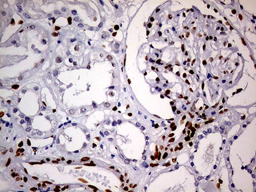 Immunohistochemical staining of paraffin-embedded Human Kidney tissue within the normal limits using anti-MEIS1 mouse monoclonal antibody. Heat-induced epitope retrieval by EDTA solution buffer pH 8.0 at 120Â°C for 3 min.