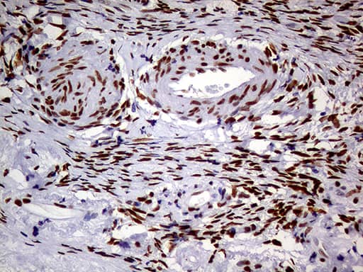 Immunohistochemical staining of paraffin-embedded Human Ovary tissue within the normal limits using anti-MEIS1 mouse monoclonal antibody. Heat-induced epitope retrieval by EDTA solution buffer pH 8.0 at 120Â°C for 3 min.