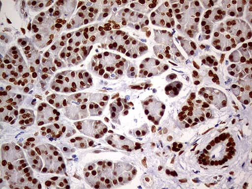 Immunohistochemical staining of paraffin-embedded Human pancreas tissue within the normal limits using anti-MEIS1 mouse monoclonal antibody. Heat-induced epitope retrieval by EDTA solution buffer pH 8.0 at 120Â°C for 3 min.