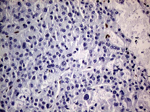 Immunohistochemical staining of paraffin-embedded Human liver tissue within the normal limits using anti-MEIS1 mouse monoclonal antibody.This figure shows negative staining. Heat-induced epitope retrieval by EDTA solution buffer pH 8.0 at 120Â°C for 3 min.