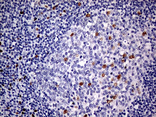 Immunohistochemical staining of paraffin-embedded Human tonsil within the normal limits using anti-MEIS1 mouse monoclonal antibody. Heat-induced epitope retrieval by EDTA solution buffer pH 8.0 at 120Â°C for 3 min.