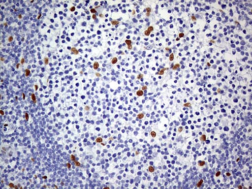 Immunohistochemical staining of paraffin-embedded Human lymph node tissue within the normal limits using anti-MEIS1 mouse monoclonal antibody. Heat-induced epitope retrieval by EDTA solution buffer pH 8.0 at 120Â°C for 3 min.