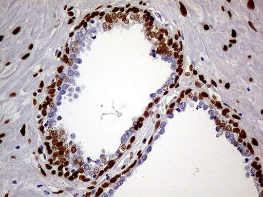 Immunohistochemical staining of paraffin-embedded Human prostate tissue within the normal limits using anti-MEIS1 mouse monoclonal antibody. Heat-induced epitope retrieval by EDTA solution buffer pH 8.0 at 120Â°C for 3 min.