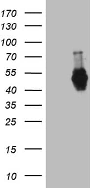 HEK293T cells were transfected with the pCMV6-ENTRY control ( Left lane) or pCMV6-ENTRY MEIS1 ( Right lane) cDNA for 48 hrs and lysed. Equivalent amounts of cell lysates (5 ug per lane) were separated by SDS-PAGE and immunoblotted with anti-MEIS1 (1:2000).