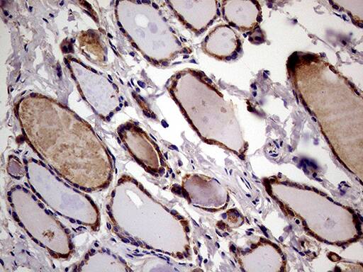Immunohistochemical staining of paraffin-embedded Human thyroid tissue within the normal limits using anti-RRBP1 mouse monoclonal antibody. Heat-induced epitope retrieval by EDTA solution buffer pH 8.0 at 120Â°C for 3 min.