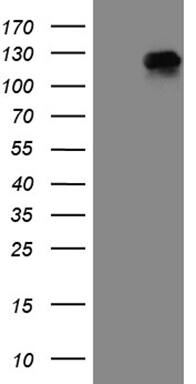 HEK293T cells were transfected with the pCMV6-ENTRY control ( Left lane) or pCMV6-ENTRY RRBP1 ( Right lane) cDNA for 48 hrs and lysed. Equivalent amounts of cell lysates (5 ug per lane) were separated by SDS-PAGE and immunoblotted with anti-RRBP1(1:2000). Positive lysates