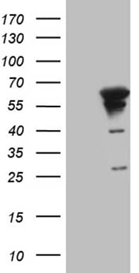 HEK293T cells were transfected with the pCMV6-ENTRY control (Left lane) or pCMV6-ENTRY MYOT (, Right lane) cDNA for 48 hrs and lysed. Equivalent amounts of cell lysates (5 ug per lane) were separated by SDS-PAGE and immunoblotted with anti-MYOT (1:2000). 