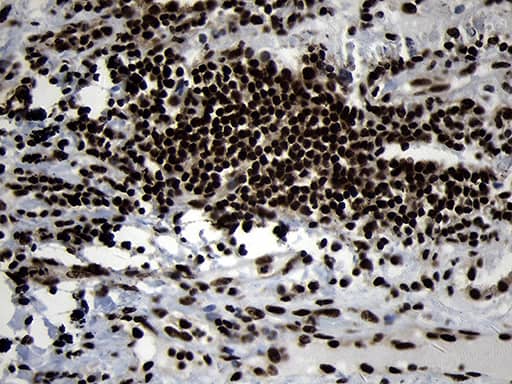 Immunohistochemistry HOXC4 Antibody (OTI1F6)