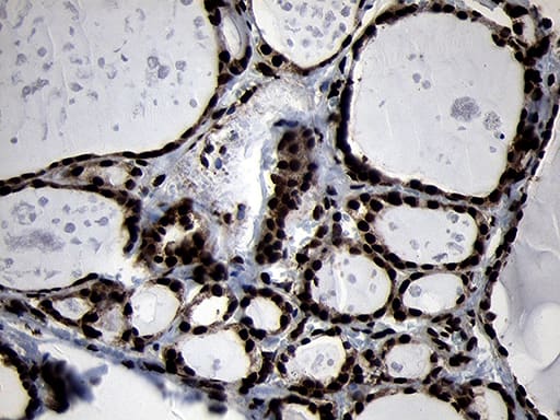 Immunohistochemical staining of paraffin-embedded Human thyroid tissue within the normal limits using anti-HOXC4 mouse monoclonal antibody. Heat-induced epitope retrieval by EDTA solution buffer pH 8.0 at 120Â°C for 3 min.
