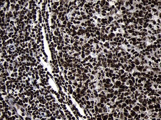 Immunohistochemical staining of paraffin-embedded Human lymph node tissue within the normal limits using anti-HOXC4 mouse monoclonal antibody. Heat-induced epitope retrieval by EDTA solution buffer pH 8.0 at 120Â°C for 3 min.