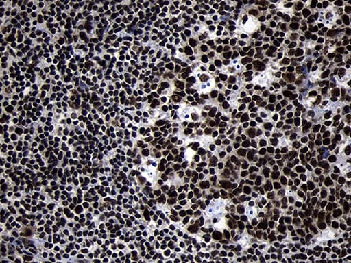 Immunohistochemical staining of paraffin-embedded Human tonsil within the normal limits using anti-HOXC4 mouse monoclonal antibody. Heat-induced epitope retrieval by EDTA solution buffer pH 8.0 at 120Â°C for 3 min.