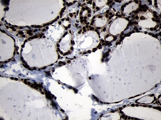 Immunohistochemical staining of paraffin-embedded Human thyroid tissue within the normal limits using anti-HOXC4 mouse monoclonal antibody. Heat-induced epitope retrieval by EDTA solution buffer pH 8.0 at 120Â°C for 3 min.