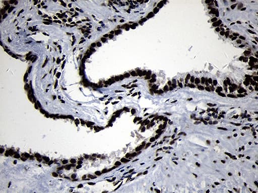Immunohistochemical staining of paraffin-embedded Human prostate tissue within the normal limits using anti-HOXC4 mouse monoclonal antibody. Heat-induced epitope retrieval by EDTA solution buffer pH 8.0 at 120Â°C for 3 min.