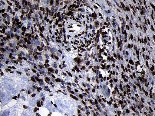 Immunohistochemical staining of paraffin-embedded Human Ovary tissue within the normal limits using anti-HOXC4 mouse monoclonal antibody. Heat-induced epitope retrieval by EDTA solution buffer pH 8.0 at 120Â°C for 3 min.