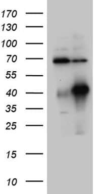 HEK293T cells were transfected with the pCMV6-ENTRY control ( Left lane) or pCMV6-ENTRY HOXC4 ( Right lane) cDNA for 48 hrs and lysed. Equivalent amounts of cell lysates (5 ug per lane) were separated by SDS-PAGE and immunoblotted with anti-HOXC4 (1:2000). Positive lysates