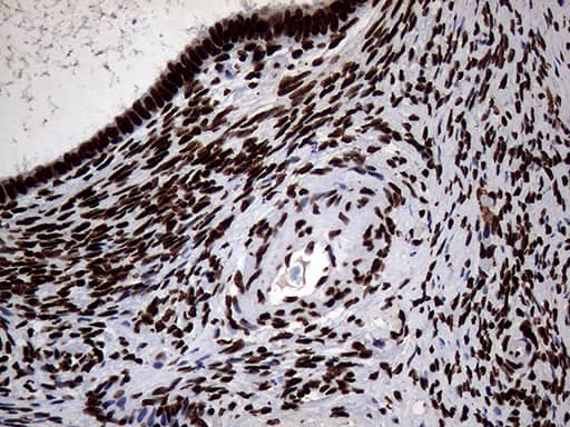 Immunohistochemical staining of paraffin-embedded Human Ovary tissue within the normal limits using anti-SH3BGRL mouse monoclonal antibody. Heat-induced epitope retrieval by EDTA solution buffer pH 8.0 at 120Â°C for 3 min.