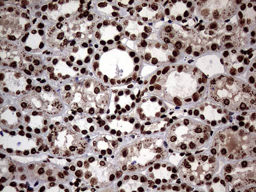 Immunohistochemistry SH3BGRL Antibody (OTI8F7)