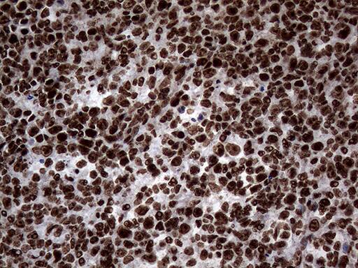 Immunohistochemical staining of paraffin-embedded Human lymph node tissue within the normal limits using anti-SH3BGRL mouse monoclonal antibody. Heat-induced epitope retrieval by EDTA solution buffer pH 8.0 at 120Â°C for 3 min.