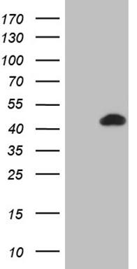 HEK293T cells were transfected with the pCMV6-ENTRY control (Left lane) or pCMV6-ENTRY BCL7B (, Right lane) cDNA for 48 hrs and lysed. Equivalent amounts of cell lysates (5 ug per lane) were separated by SDS-PAGE and immunoblotted with anti-BCL7B (1:2000). 