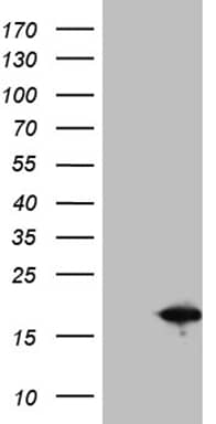 HEK293T cells were transfected with the pCMV6-ENTRY control (Left lane) or pCMV6-ENTRY SH3BGRL (, Right lane) cDNA for 48 hrs and lysed. Equivalent amounts of cell lysates (5 ug per lane) were separated by SDS-PAGE and immunoblotted with anti-SH3BGRL (1:2000). 