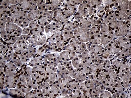 Immunohistochemical staining of paraffin-embedded Human pancreas tissue within the normal limits using anti-SUPT16H mouse monoclonal antibody. Heat-induced epitope retrieval by EDTA solution buffer pH 8.0 at 120Â°C for 3 min.