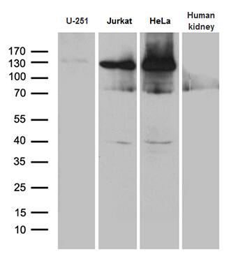 Western blot analysis of extracts (35ug) from 3 different cell lines and human kidney tissue lysate by using anti-SUPT16H monoclonal antibody (1:500).