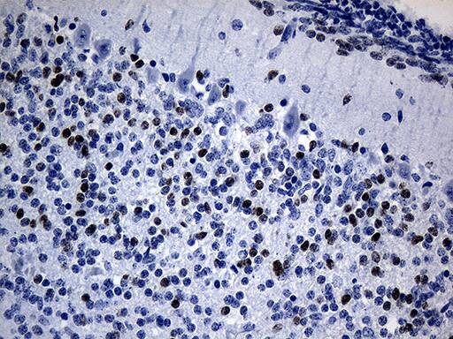 Immunohistochemical staining of paraffin-embedded Human embryonic cerebellum within the normal limits using anti-PHF20L1 mouse monoclonal antibody. Heat-induced epitope retrieval by EDTA solution buffer pH 8.0 at 120Â°C for 3 min.