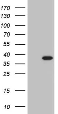 HEK293T cells were transfected with the pCMV6-ENTRY control ( Left lane) or pCMV6-ENTRY PHF20L1 ( Right lane) cDNA for 48 hrs and lysed. Equivalent amounts of cell lysates (5 ug per lane) were separated by SDS-PAGE and immunoblotted with anti-PHF20L1 (1:2000). Positive lysates